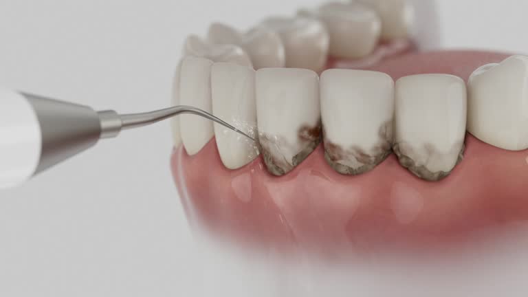 Reliable Dental Implants contractor in Lyman, SC by Smile Center Dentistry